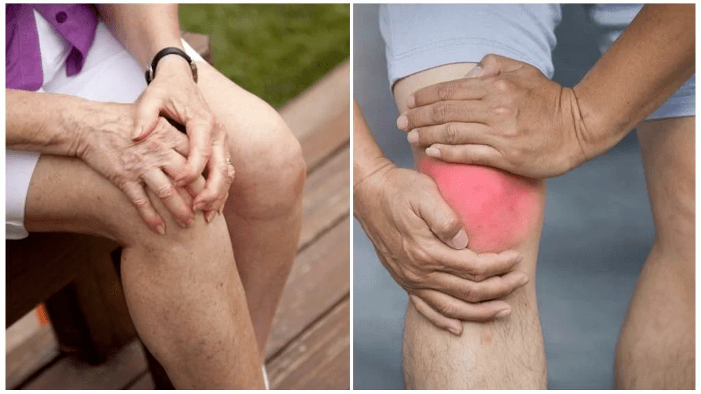 Behandlung von Arthrose